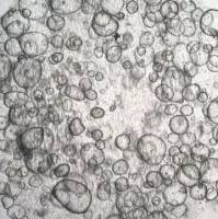 3dGRO Duodenum Intestinal Organoids, Age 59 (Prep ht-215-D)