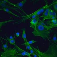 默克Merck OSUMMER.5 Mouse NRAS-Mutant Melanoma Cell Line