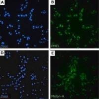 默克Merck sBT-RMS Spontaneous Brain-tropic RET Melanoma-sorted Mouse Cell Line