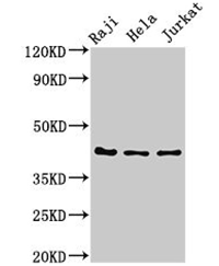 妊娠相关糖蛋白1（PAG1）抗体，爆款商品限时抢