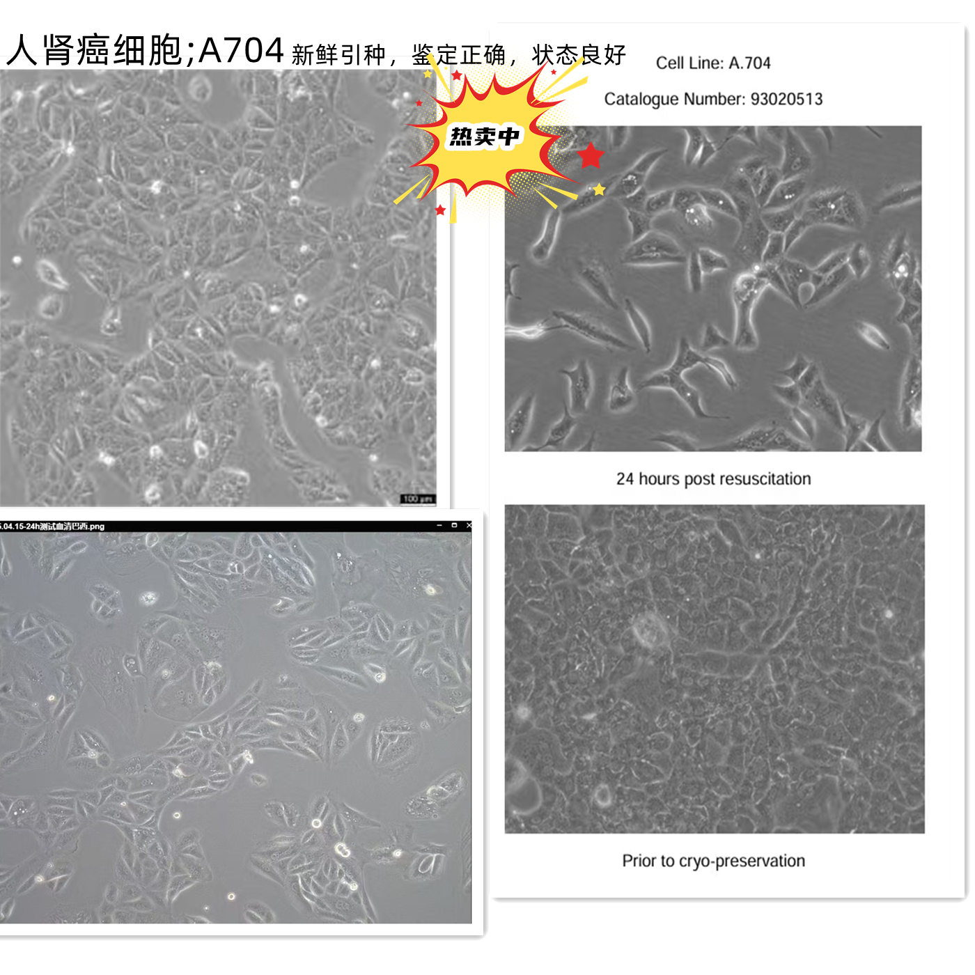 人肾癌细胞;A704
