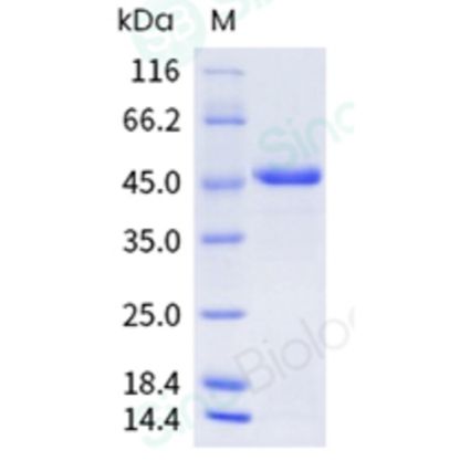 Recombinant Human Dectin-1/CLEC7A Protein (mFc Tag), HPLC-verified