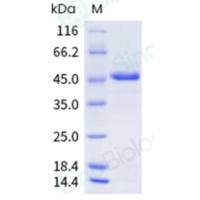 Recombinant Human Dectin-1/CLEC7A Protein (mFc Tag), HPLC-verified
