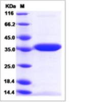 Recombinant Mouse LDHA Protein (His Tag)