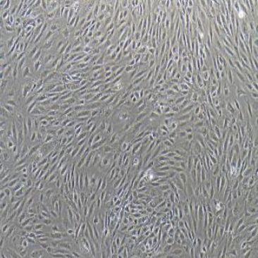 B16-Fo小鼠黑色素瘤细胞价格