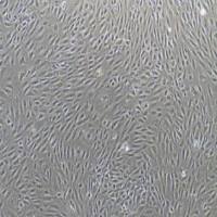 B16-Fo小鼠黑色素瘤细胞价格