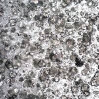 3dGRO® Human Lung Organoids (PDXO.149)