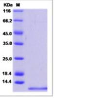 Recombinant Human CD81 Protein (ECD, His Tag)