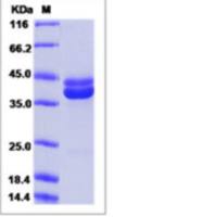 Recombinant Human Mammaglobin B/SCGB2A1 Protein (hFc Tag)