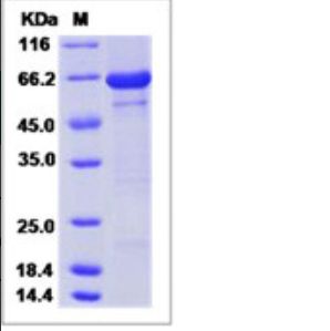 Recombinant Human PADI4 / PAD4 Protein (His Tag)
