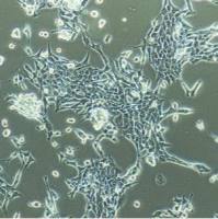 Y79人视网膜母细胞瘤细胞价格