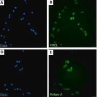 默克Merck sLT-RMS Spontaneous Lung-tropic RET Melanoma-sorted Mouse Cell Line