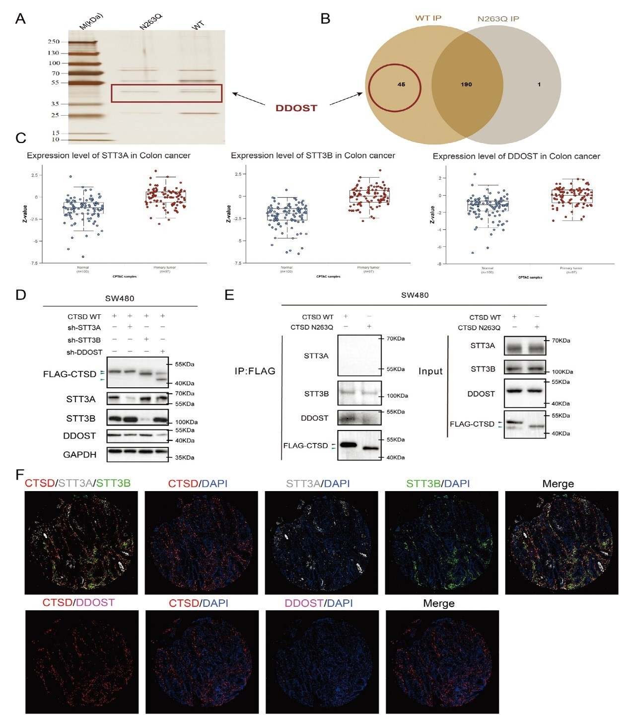 北京大学人民医院胃肠外科团队发现CTSD N-糖基化修饰影响结直肠癌肝转移