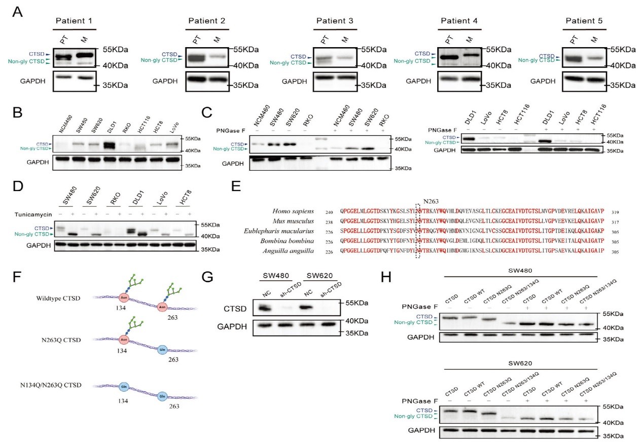 北京大学人民医院胃肠外科团队发现CTSD N-糖基化修饰影响结直肠癌肝转移