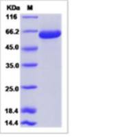 Recombinant Rat EphB3 Protein (ECD, His Tag)