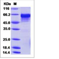Recombinant Human methionyl aminopeptidase 2/METAP2 Protein (His Tag)