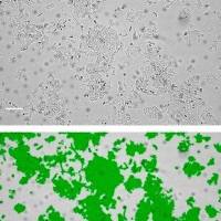 默克Merck HCI-EC-23 Human Endometrial Cancer Cell Line