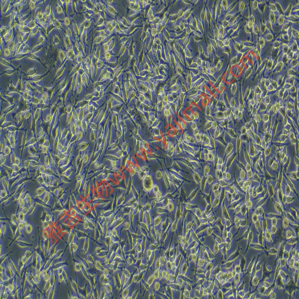 人神经母细胞瘤细胞shsy5y/LUC(带荧光素酶)价格