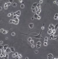 默克Merck VOA1066 Human Undifferentiated Endometrial Carcinoma Cell Line