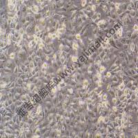 Hi-fiveBTI-TN-5B1-4昆虫细胞/LUC(带荧光素酶)价格