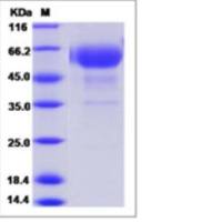 Recombinant Cynomolgus CD28 Protein (ECD, hFc Tag)