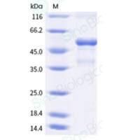 Recombinant Human 4-1BB Ligand/TNFSF9 Protein (ECD, hFc Tag)
