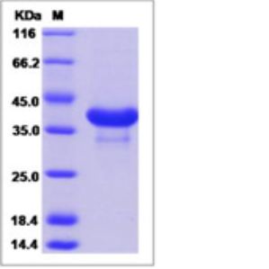 Recombinant Mouse CD81 Protein (ECD, mFc Tag)