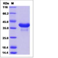 Recombinant Mouse CD81 Protein (ECD, mFc Tag)
