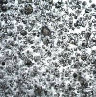 3dGRO® Human Lung Organoids (LPTO.126)