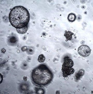 3dGRO® Human Lung Organoids (LPTO.85)产品图