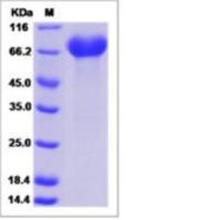 Recombinant Human EphA1 Protein (ECD, His Tag)