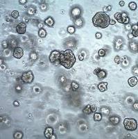 dGRO® Human Lung Organoids (PDXO.4056)