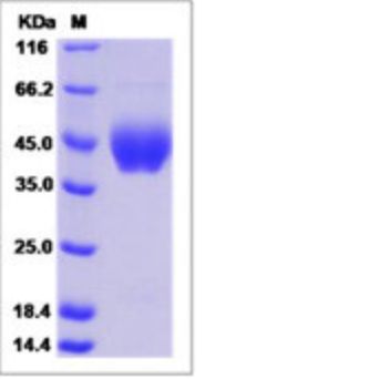 Recombinant Human Neuregulin-1/NRG1 Protein (ECD, His Tag)
