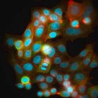 默克Merck HCC95 Human Lung Squamous Carcinoma Cell Line