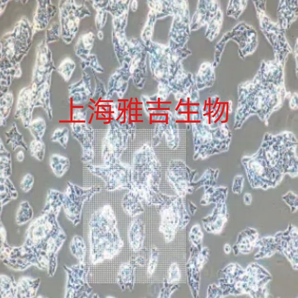 人急性T淋巴细胞白血病细胞CEMC7/RFP  (带红色荧光)价格