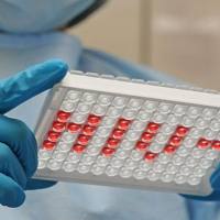 免疫印迹系列检测试剂盒-德国DRG原装进口