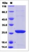 Recombinant Human GSTT2B Protein (His Tag)