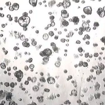 3dGRO® Pancreatic Organoids (PPTO.90)