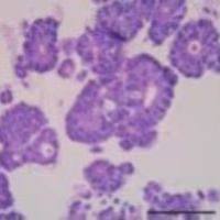 3dGRO® Human CRC Organoids (ISO68)