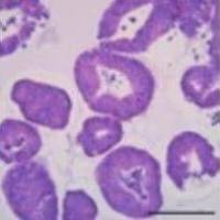 3dGRO® Human CRC Organoids (ISO49)