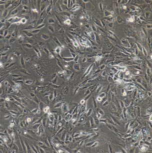 小鼠结缔组织细胞胸苷激酶缺陷株L-M(TK-)/GFP (带绿色荧光)ATCC