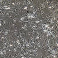 原代白癜风人皮肤黑色素细胞PIG3/GFP (带绿色荧光)ATCC