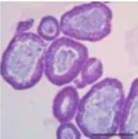 3dGRO® Human CRC Organoids (ISO72)