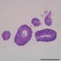 3dGRO® Human CRC Organoids (ISO57)