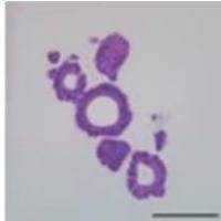 3dGRO® Human CRC Organoids (ISO38)