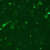 人喉癌细胞TU138/GFP (带绿色荧光)ATCC