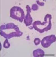3dGRO® Human CRC Organoids (ISO48)