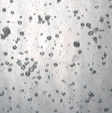 3dGRO® Colorectal Organoids (POP.170)