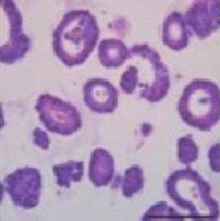 3dGRO® Human CRC Organoids (ISO50)