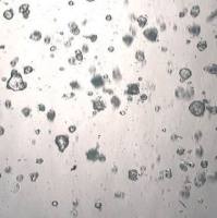 3dGRO® Pancreatic Organoids (PPTO.64)